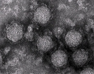 チクングニアウイルスの写真