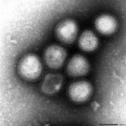 鳥インフルエンザA(H7N9)の写真
