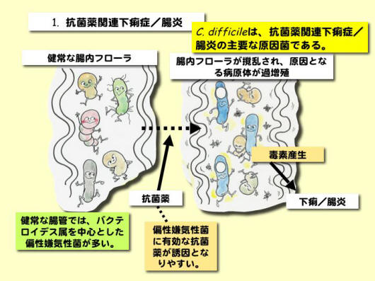 「賢い菌」から「悪い菌」へ変化していく腸内の環境