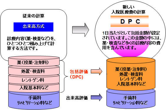 DPC