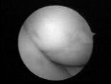 endoscope4