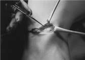endoscope5